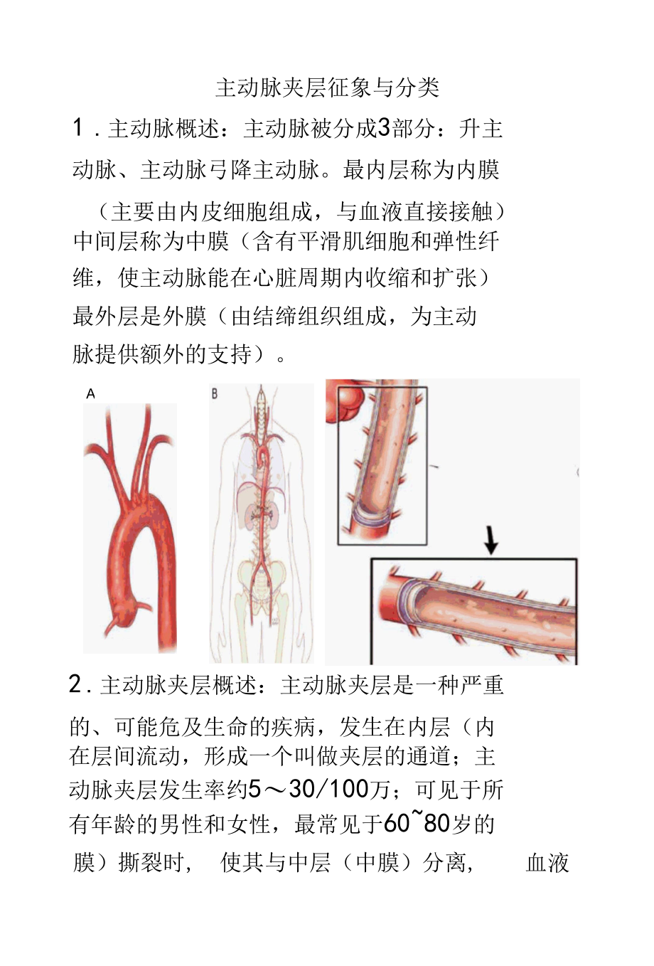 主动脉夹层的影像诊断.docx_第1页