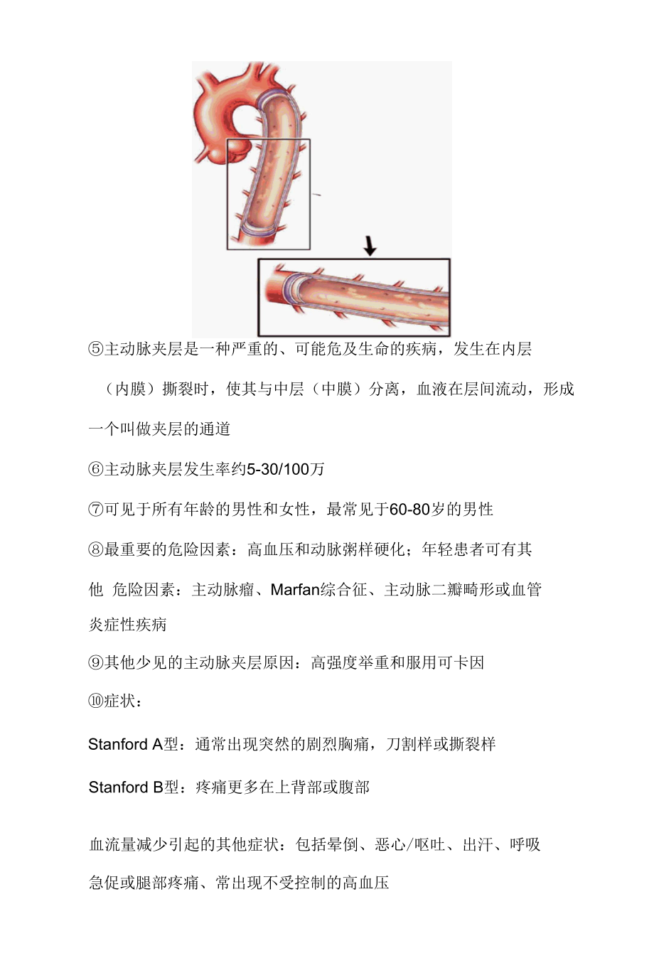 主动脉夹层.docx_第2页