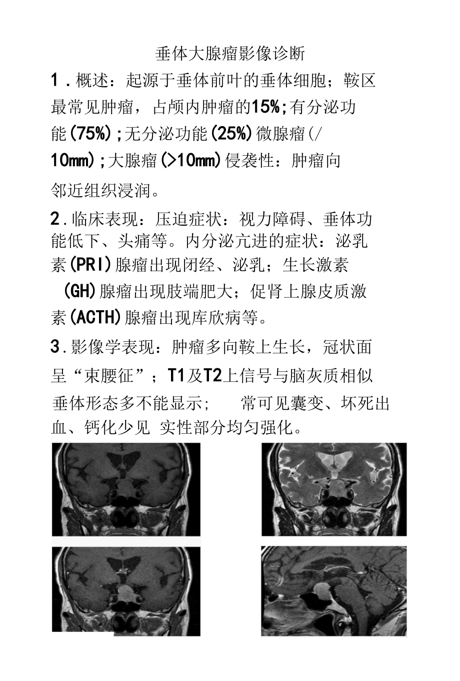 垂体大腺瘤影像诊断.docx_第1页