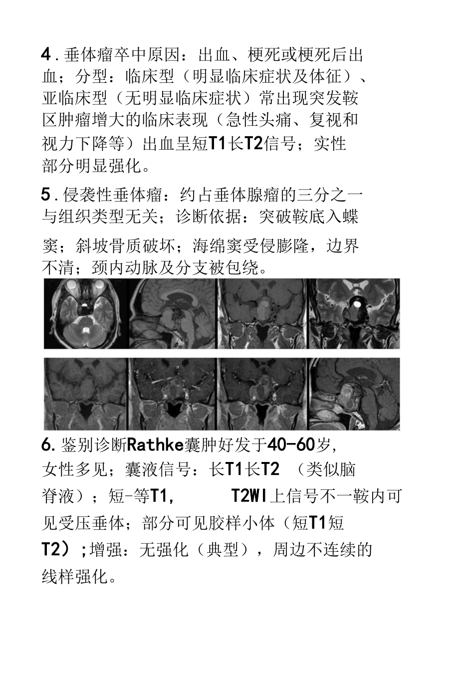 垂体大腺瘤影像诊断.docx_第2页