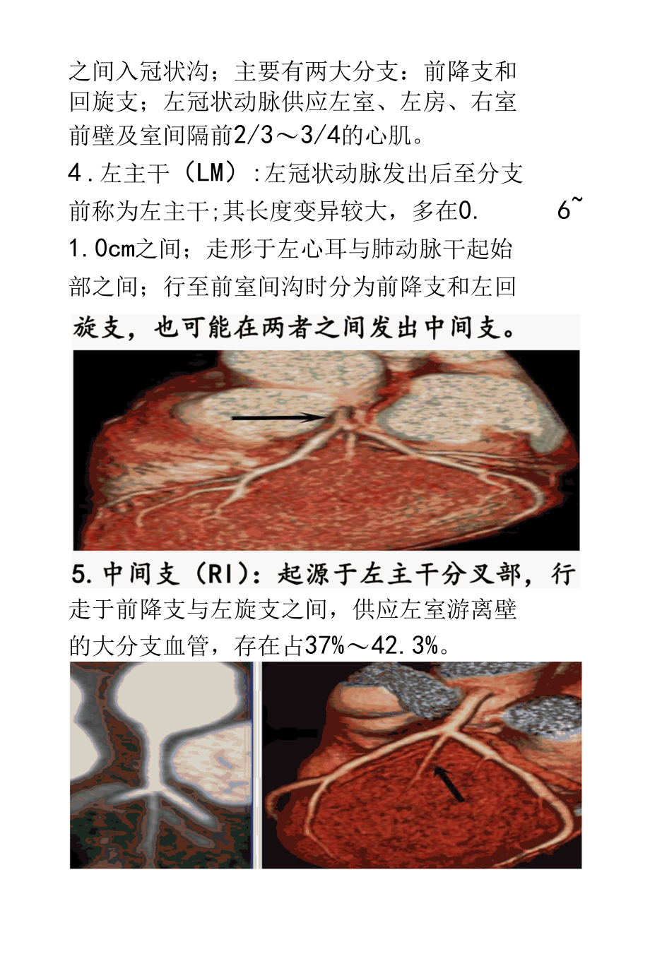 冠状动脉解剖及病变的影像学诊断.docx_第2页