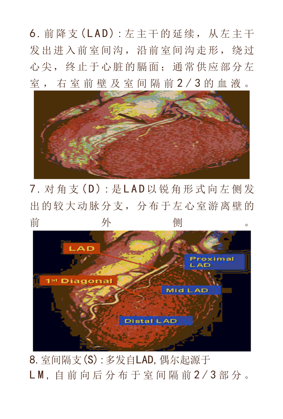 冠状动脉解剖及病变的影像学诊断.docx_第3页