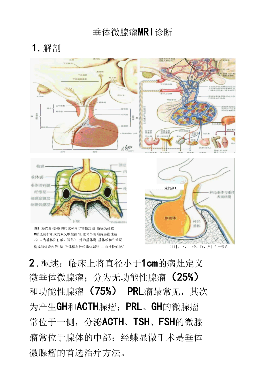 垂体微腺瘤影像诊断.docx_第1页