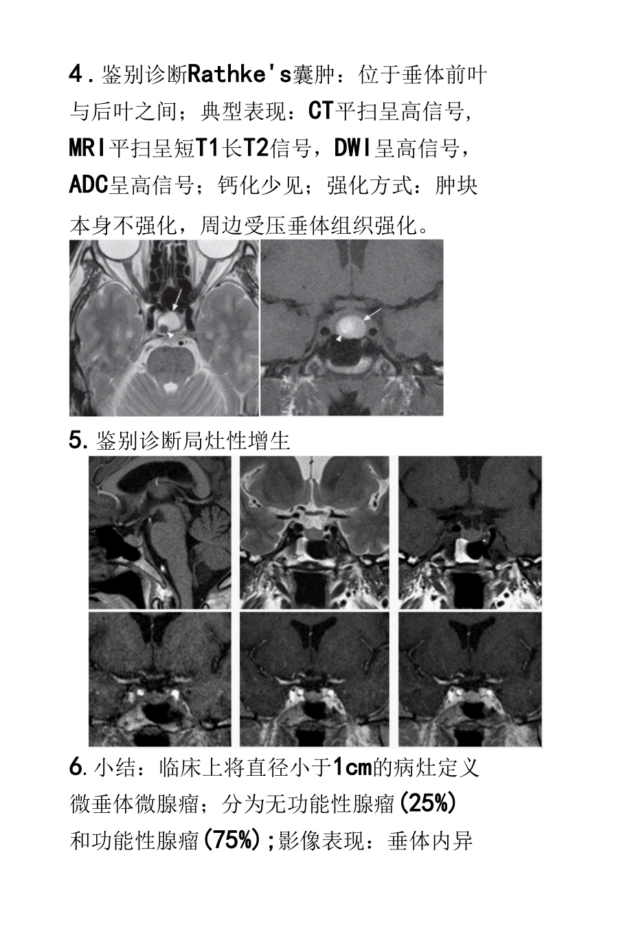 垂体微腺瘤影像诊断.docx_第3页