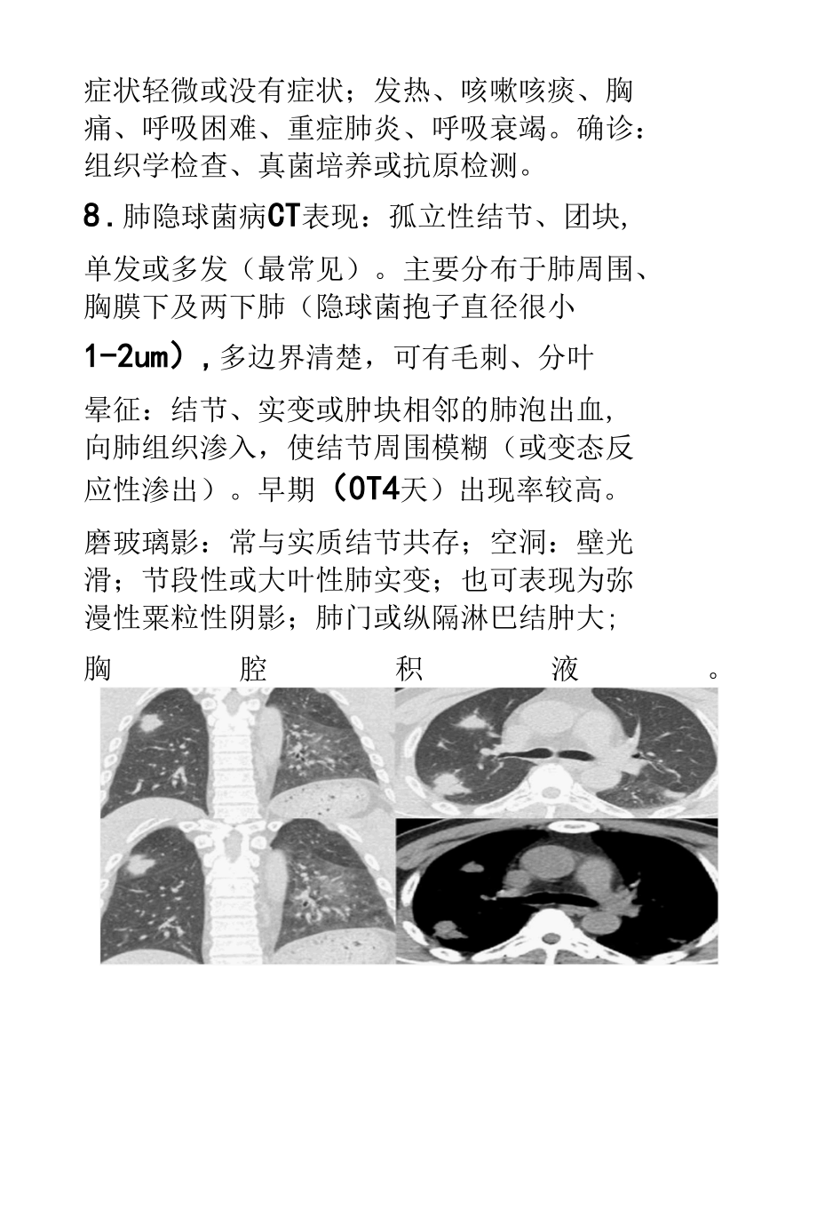 肺真菌性疾病的影像诊断.docx_第3页