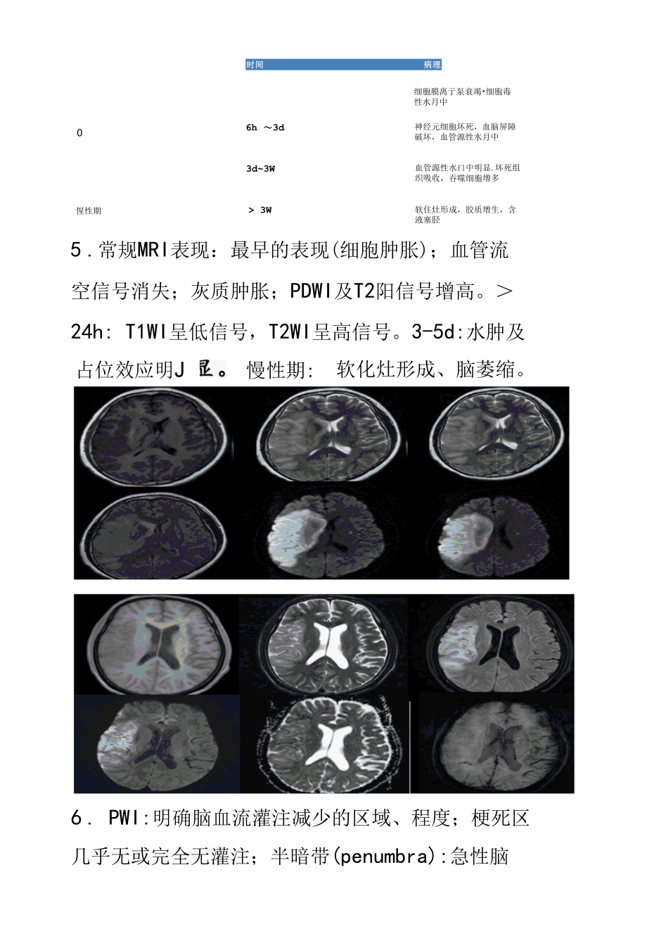 脑梗死MR诊断与鉴别诊断.docx_第1页