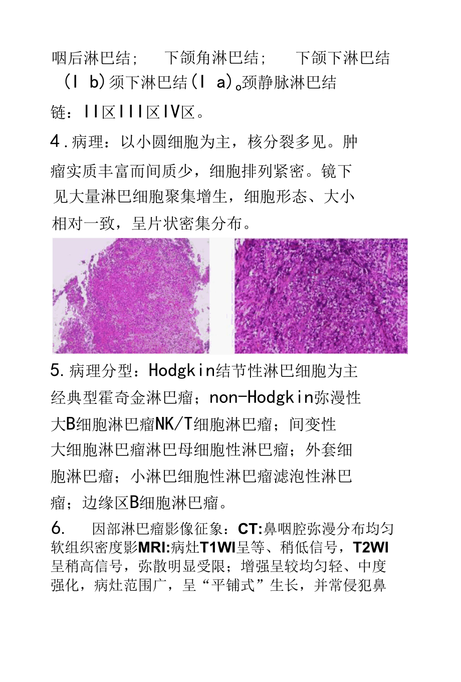 鼻咽部淋巴瘤影像诊断.docx_第3页