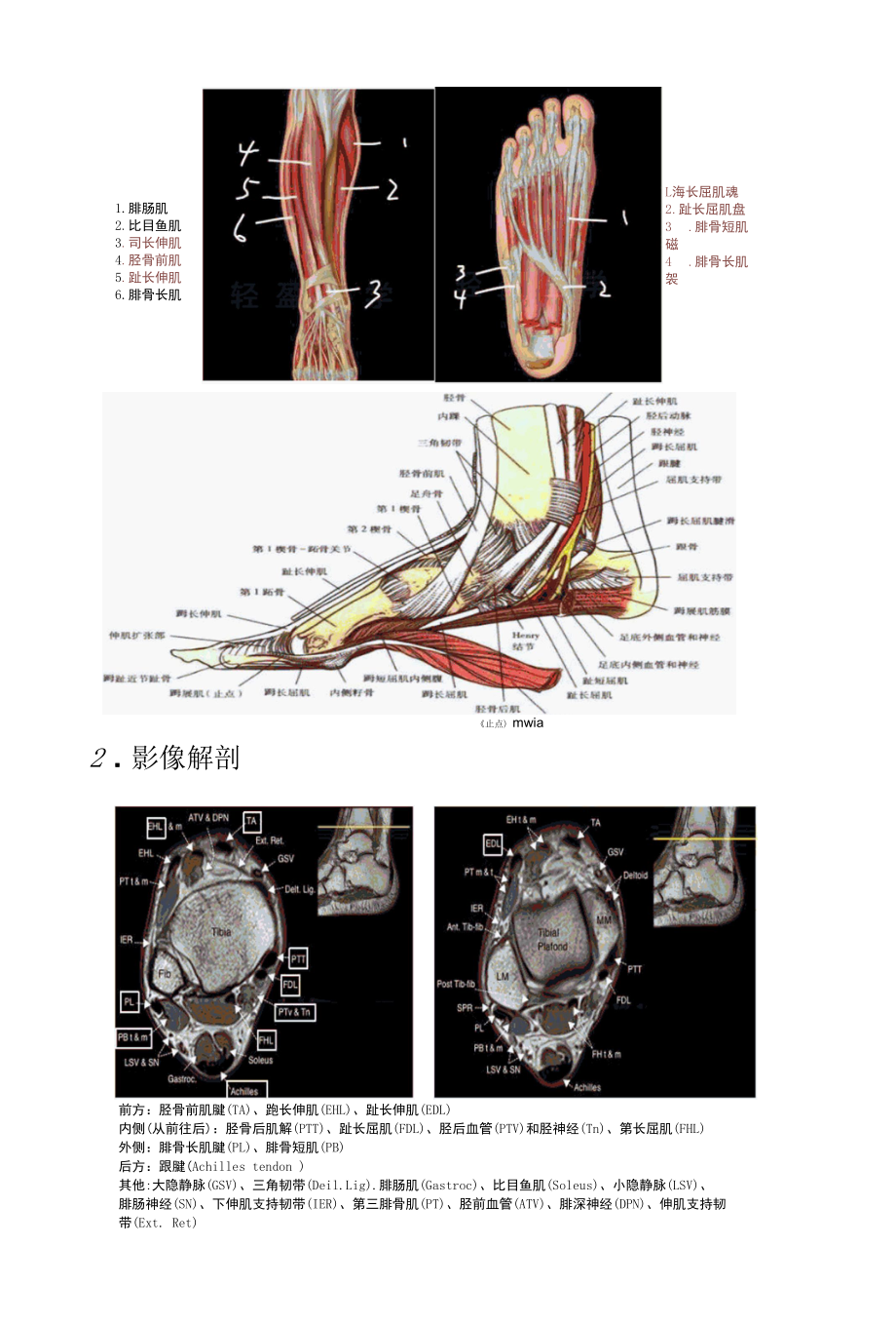 踝关节损伤的影像学诊断及踝关节韧带解剖.docx_第2页