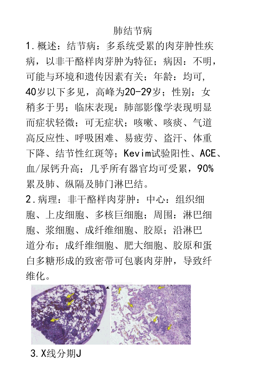 肺结节病的影像学诊断及鉴别诊断.docx_第1页