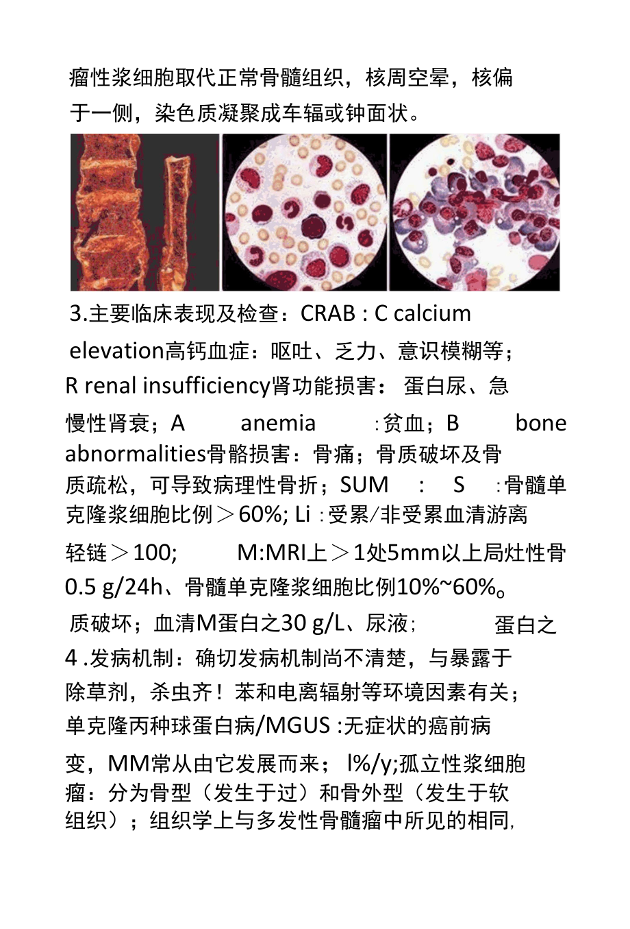 锥体骨髓瘤的影像学诊断及鉴别诊断.docx_第2页