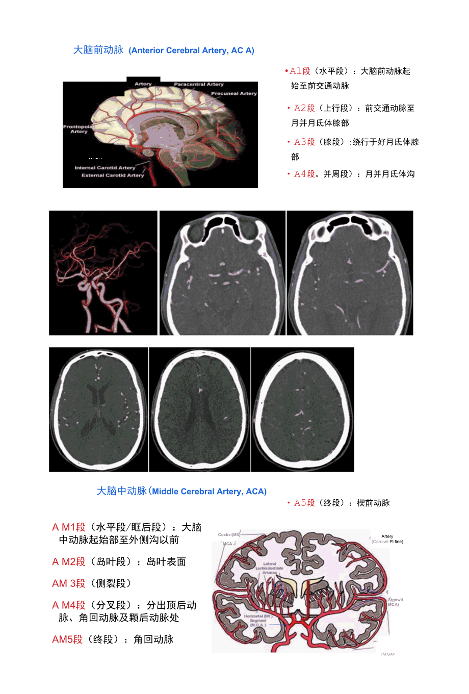 脑动脉分段、脑动脉瘤及动静脉畸形影像诊断及鉴别诊断.docx_第3页