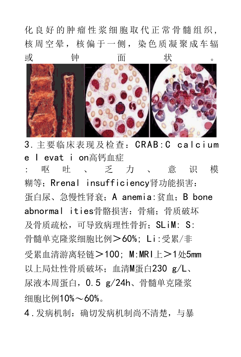 椎体骨髓瘤的影像诊断及鉴别诊断.docx_第1页