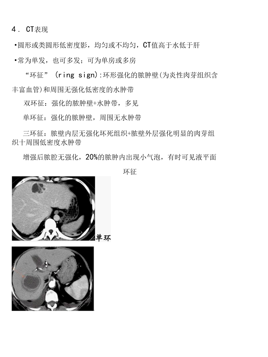 肝脓肿影像学诊断.docx_第2页