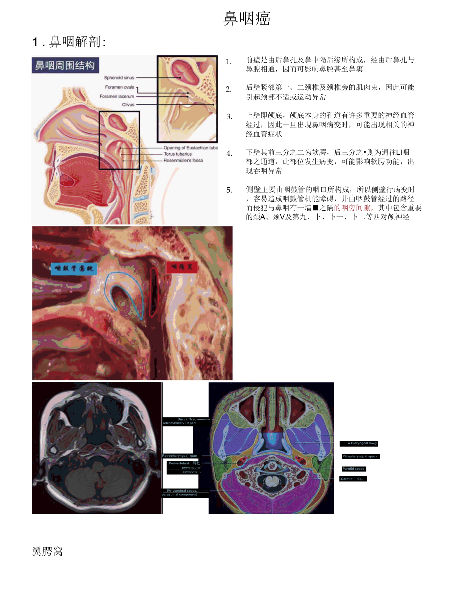 鼻咽癌影像学诊断.docx_第1页