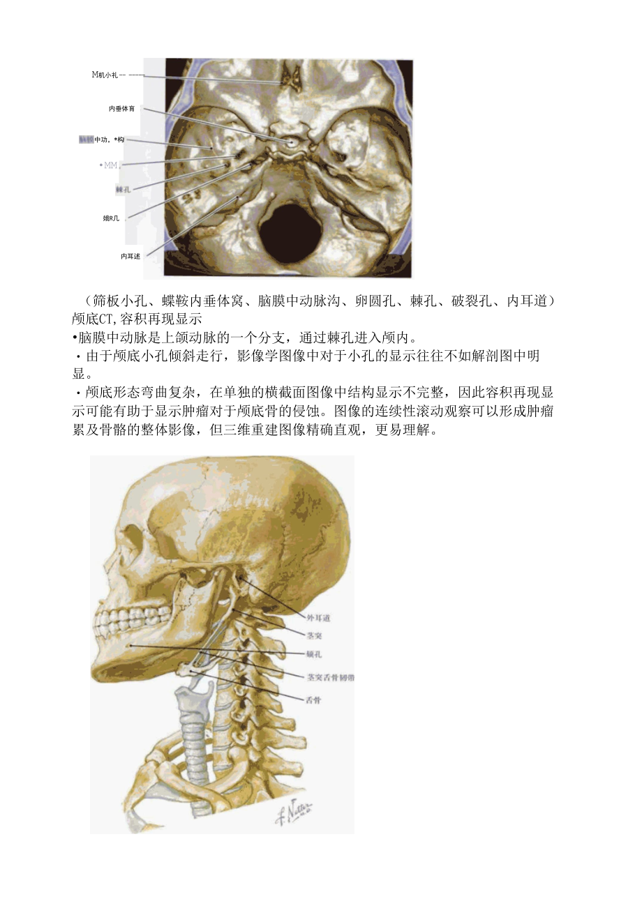 颅骨解剖及CT三维重建.docx_第3页