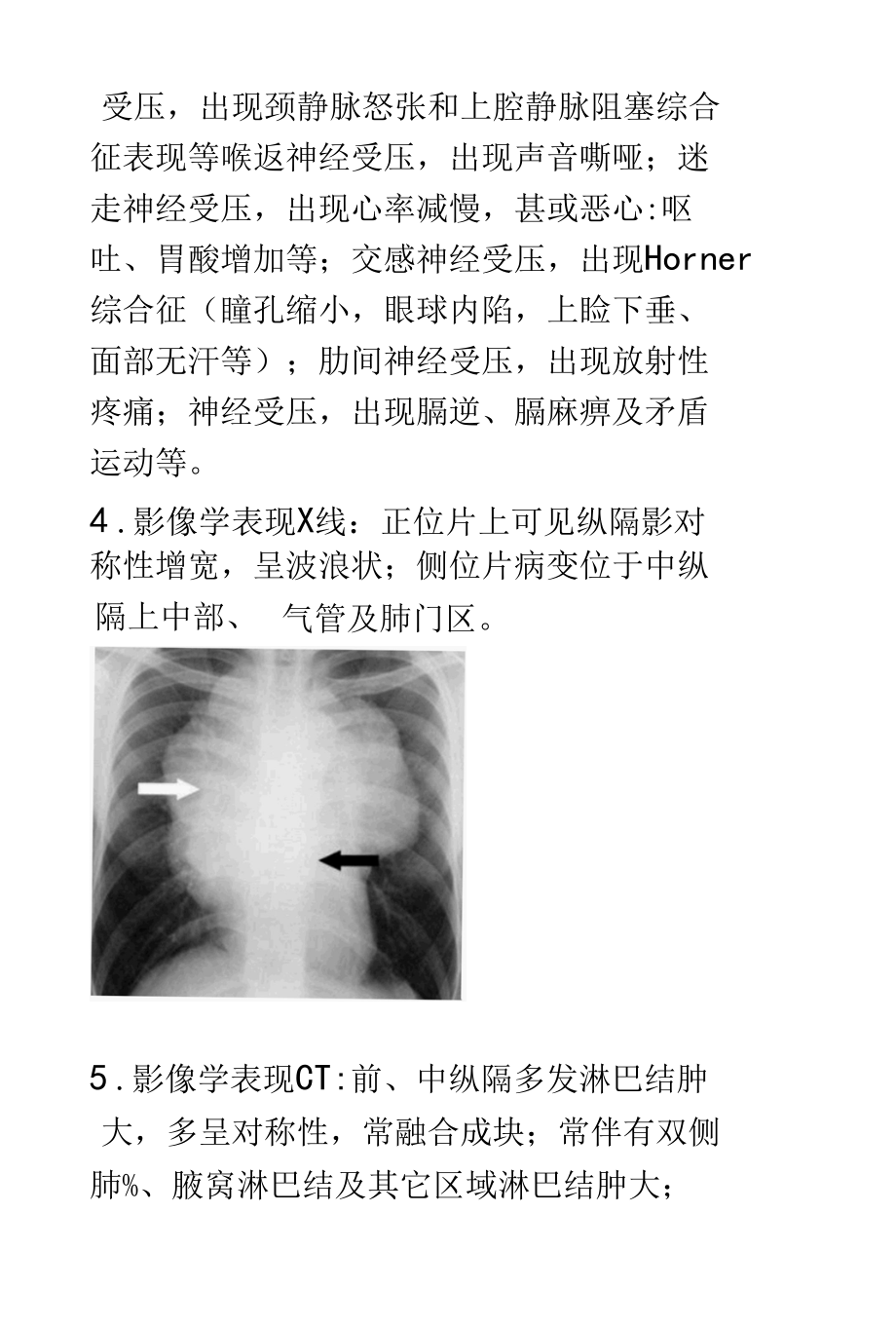 纵膈淋巴瘤影像诊断.docx_第2页