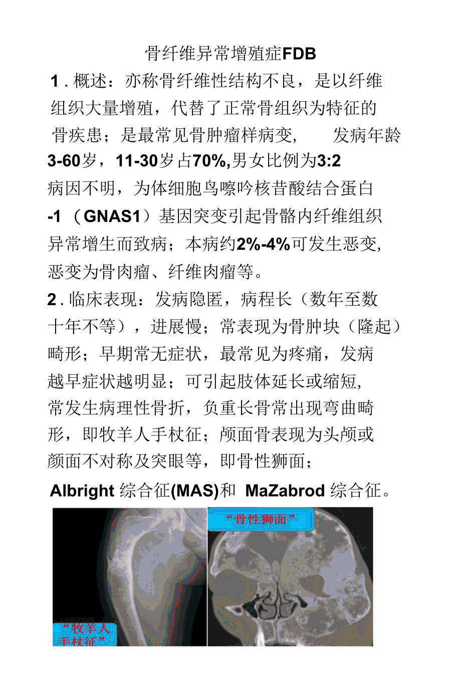 骨纤维异常增殖症FDB的影像诊断及鉴别诊断.docx_第1页