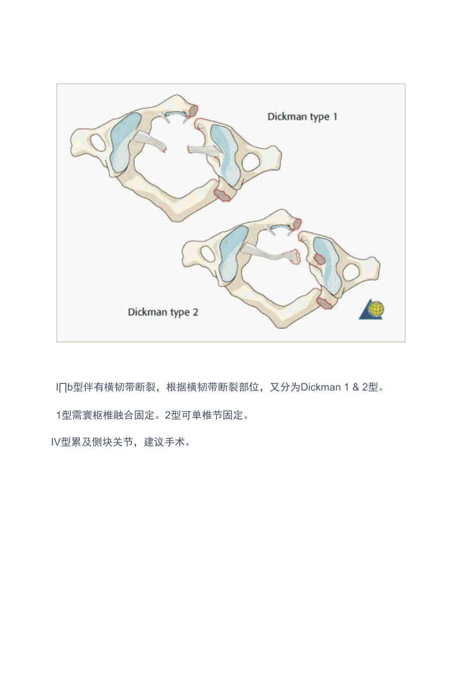 全脊柱骨折AO分型图谱.docx_第2页