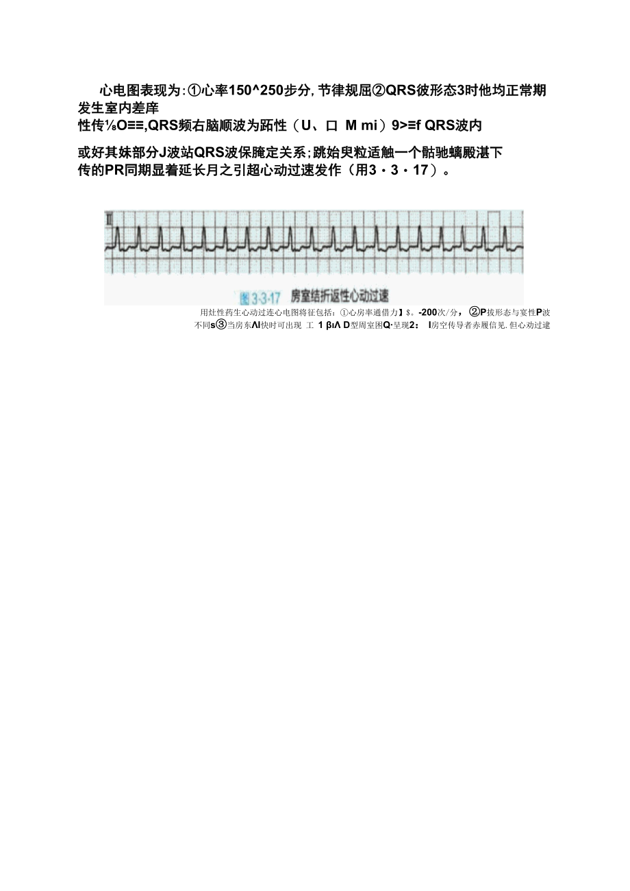 室上性心动过速患者的麻醉管理.docx_第2页