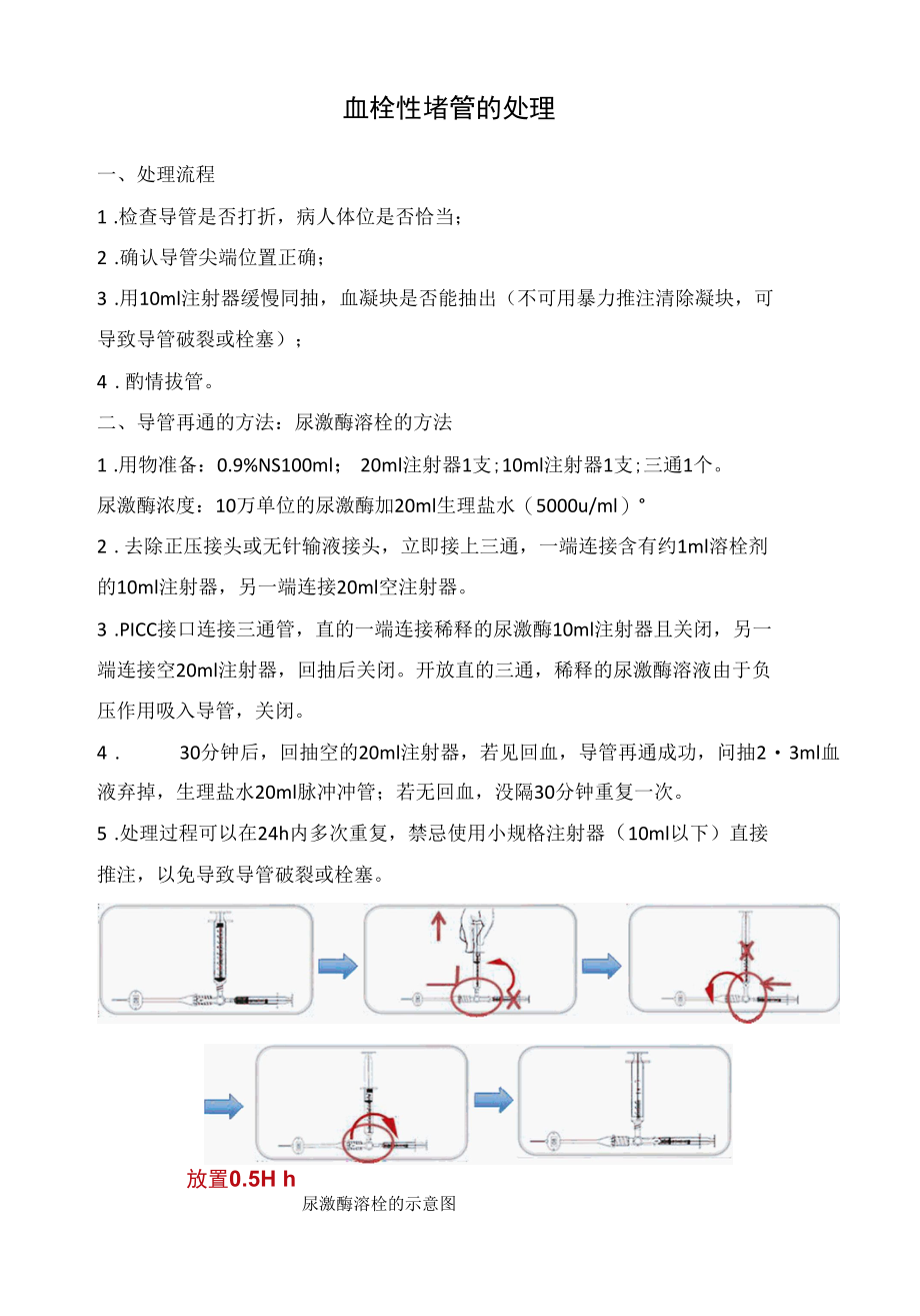 血栓性堵管的处理.docx_第1页