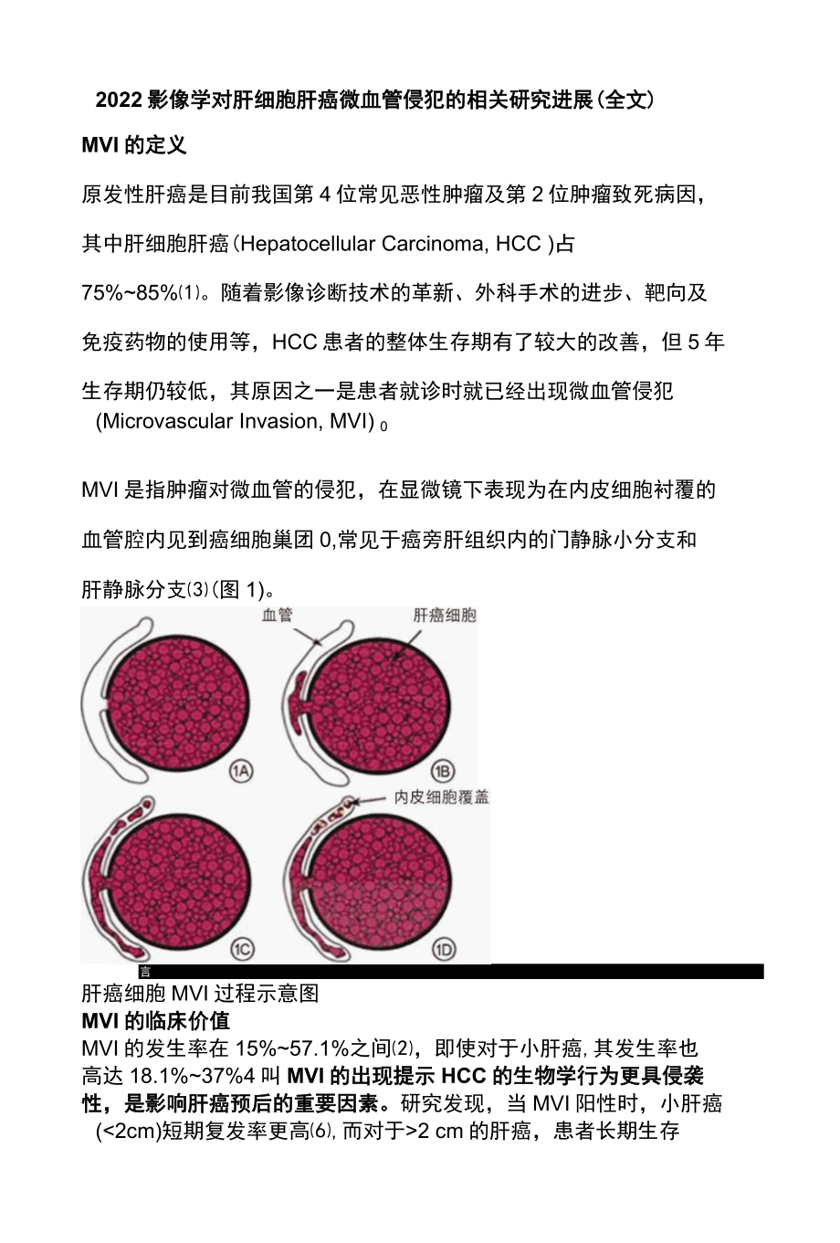 2022影像学对肝细胞肝癌微血管侵犯的相关研究进展全文.docx_第1页