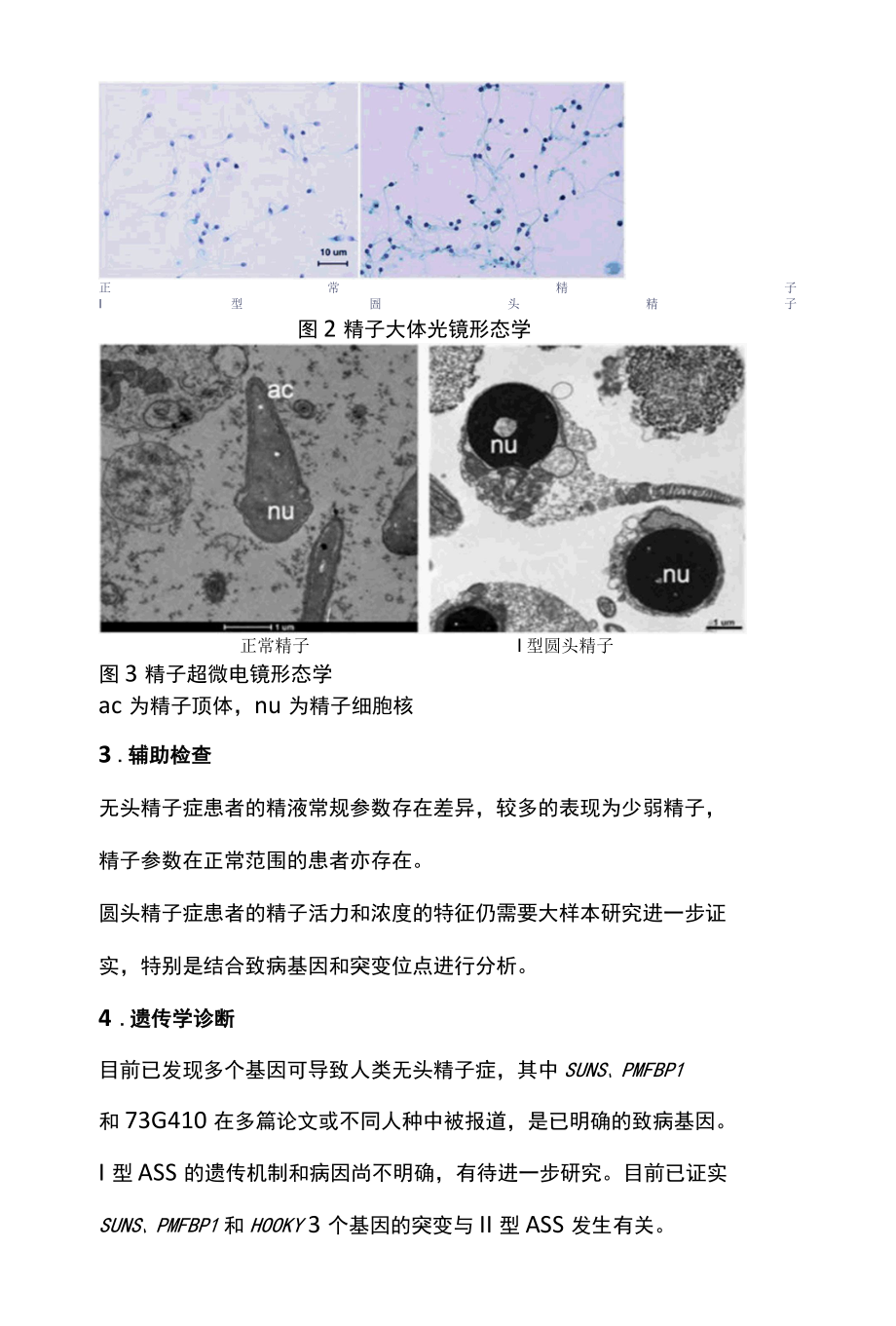 2022特殊类畸形精子症的诊疗全文.docx_第3页