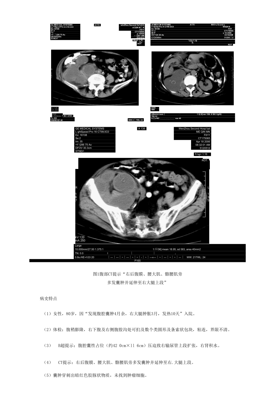 实用临床基础课程病例模板1.docx_第2页