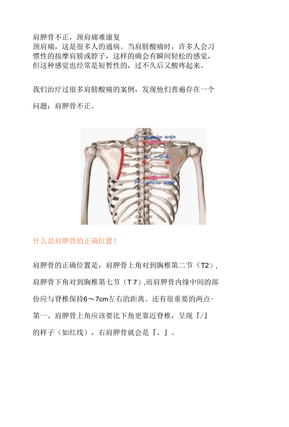 肩胛骨不正,颈肩痛难康复.docx_第1页