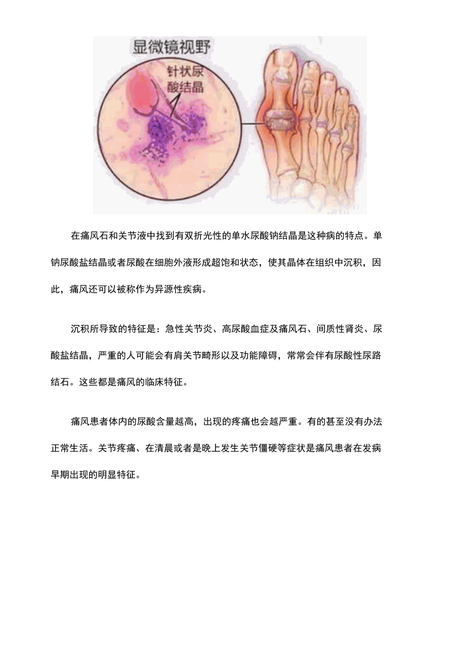 痛风患者能不能吃豆类？.docx_第3页