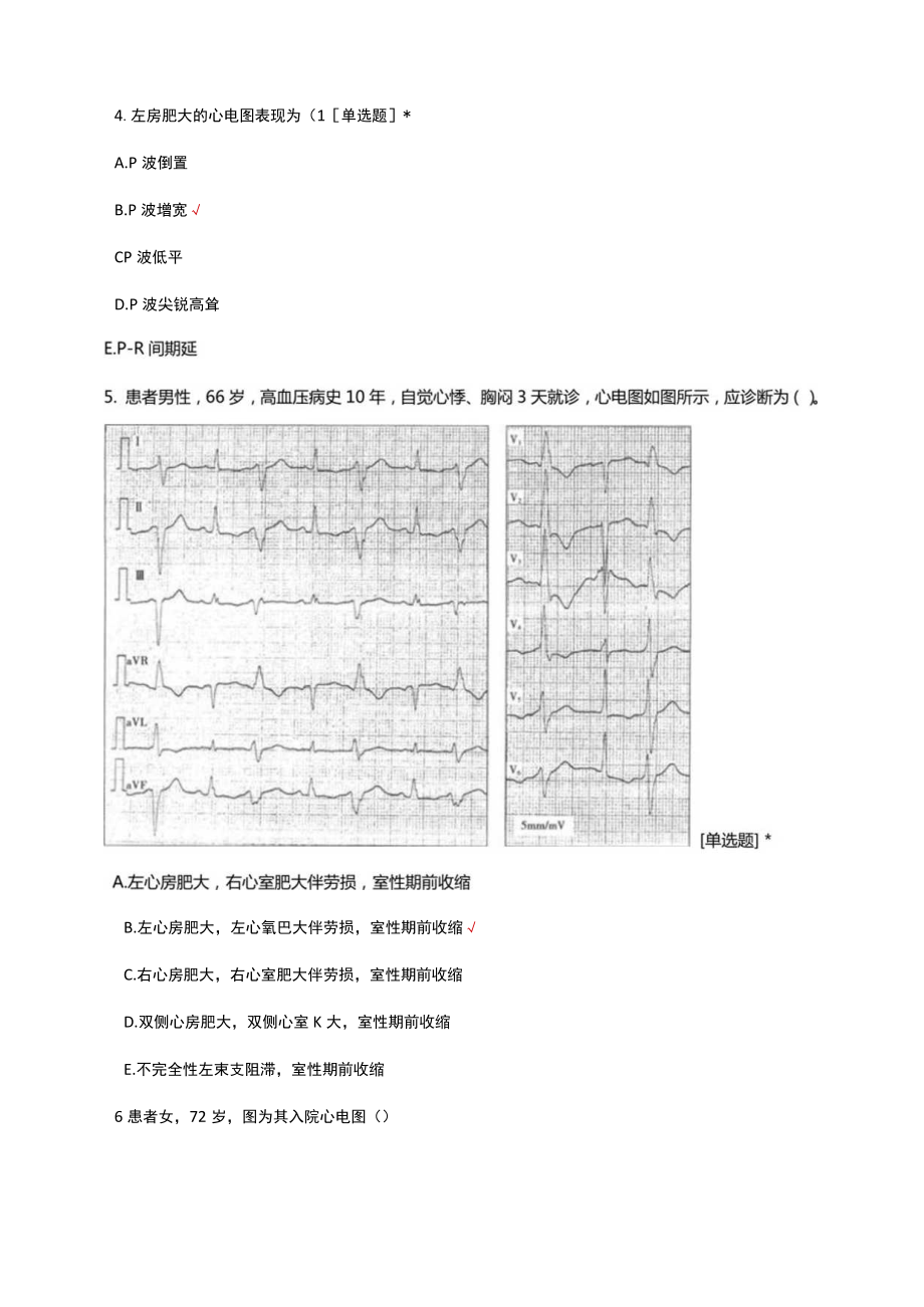 常见异常心电图正确识别理论考核试题题库及答案.docx_第2页