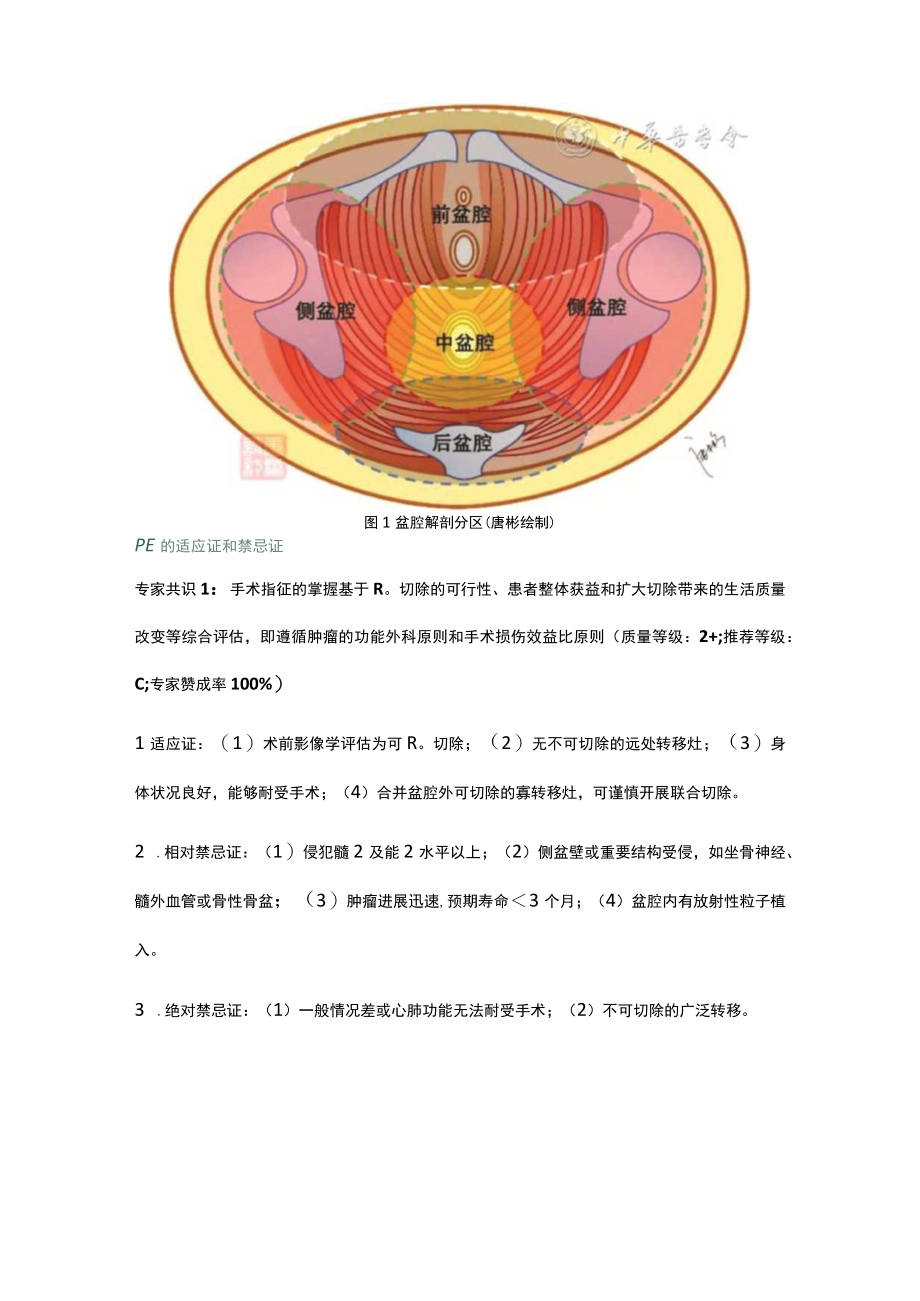 超全直肠系膜切除层面的原发性直肠癌和局部复发直肠癌盆腔脏器联合切除中国专家共识（2023版）.docx_第3页