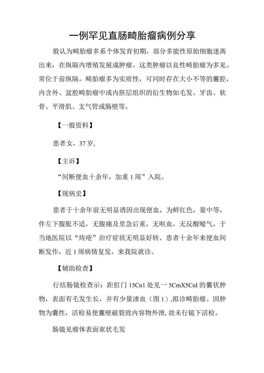 外科医师晋升副主任（主任）医师例分析专题报告（直肠畸胎瘤）.docx_第2页