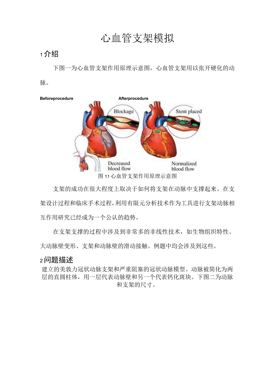 CAE心血管支架模拟.docx_第1页