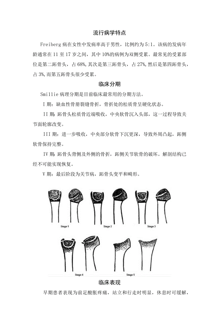 引起前足痛Freiberg病病理机制临床表现流行病学特点临床表现影像学检查治疗及总结.docx_第2页