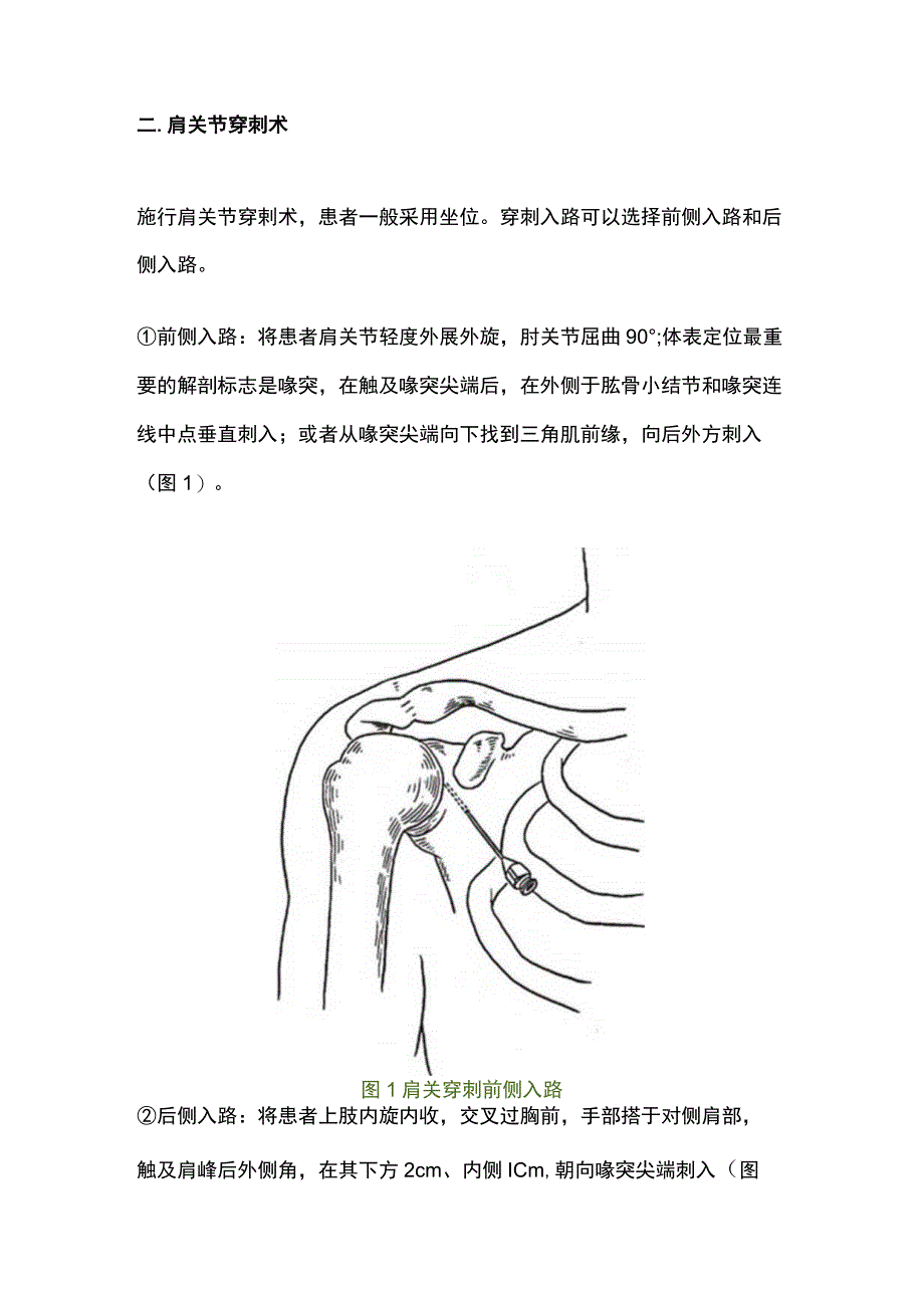 最新：各关节穿剌术的技巧及注意事项.docx_第2页