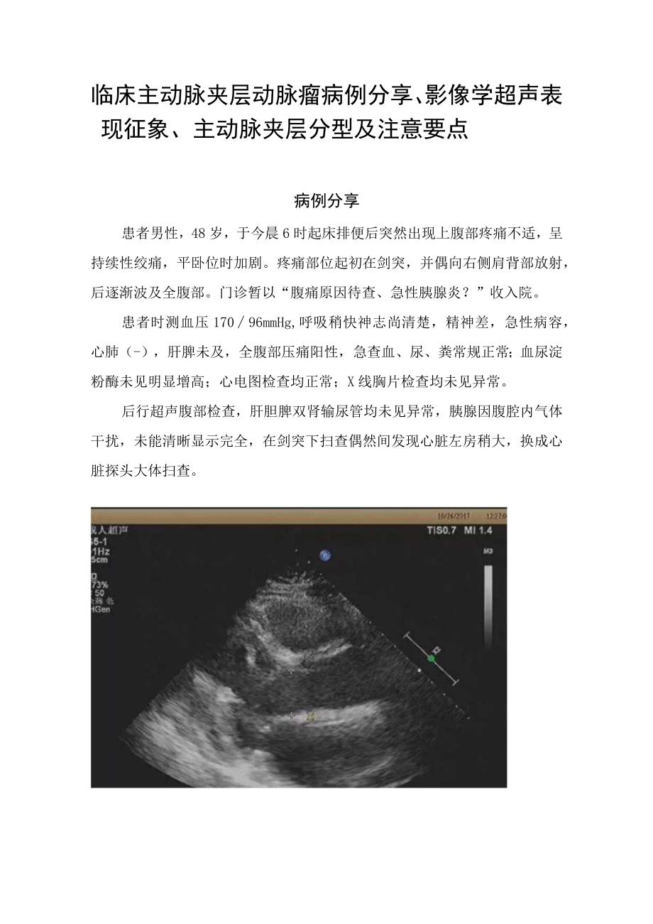 临床主动脉夹层动脉瘤病例分享影像学超声表现征象主动脉夹层分型及注意要点.docx_第1页