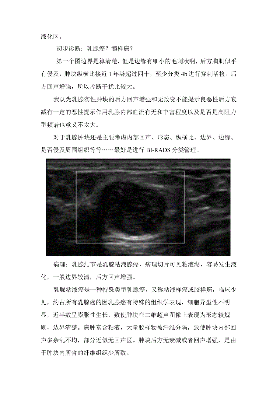 临床乳腺粘液腺癌病例分享临床表现病理特征及分型及治疗注意事项.docx_第2页