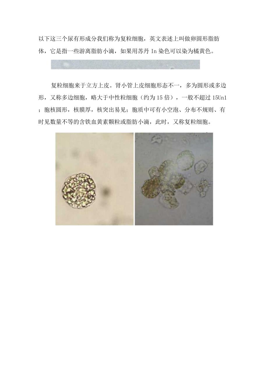 临床肾病综合诊断标准检验显微镜显示及复粒细胞具体描述.docx_第2页