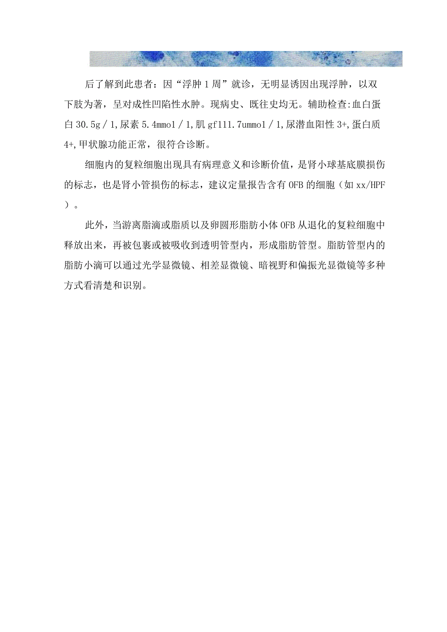 临床肾病综合诊断标准检验显微镜显示及复粒细胞具体描述.docx_第3页