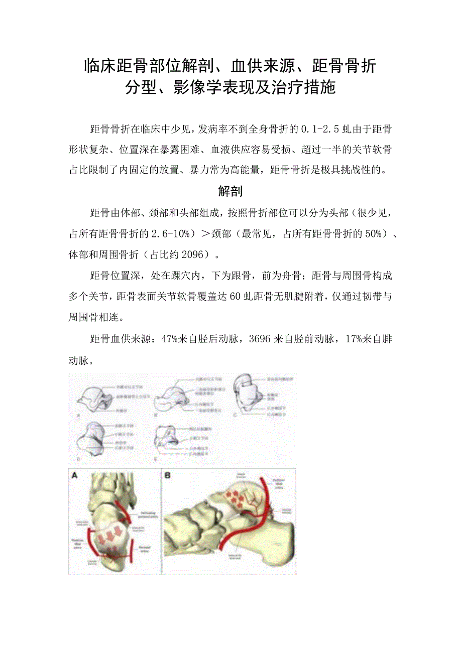 临床距骨部位解剖血供来源距骨骨折分型影像学表现及治疗措施.docx_第1页