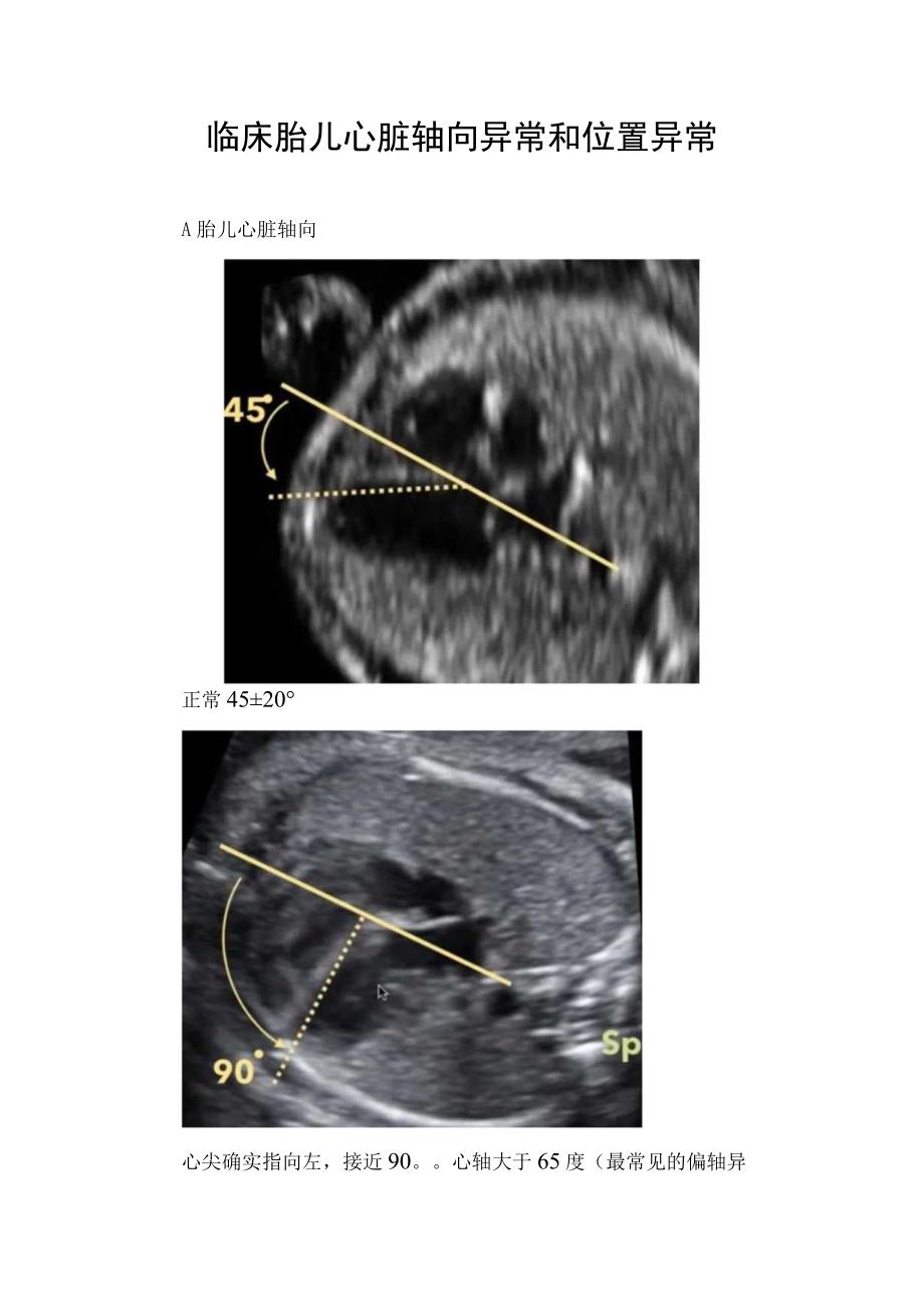 临床胎儿心脏轴向异常和位置异常.docx_第1页