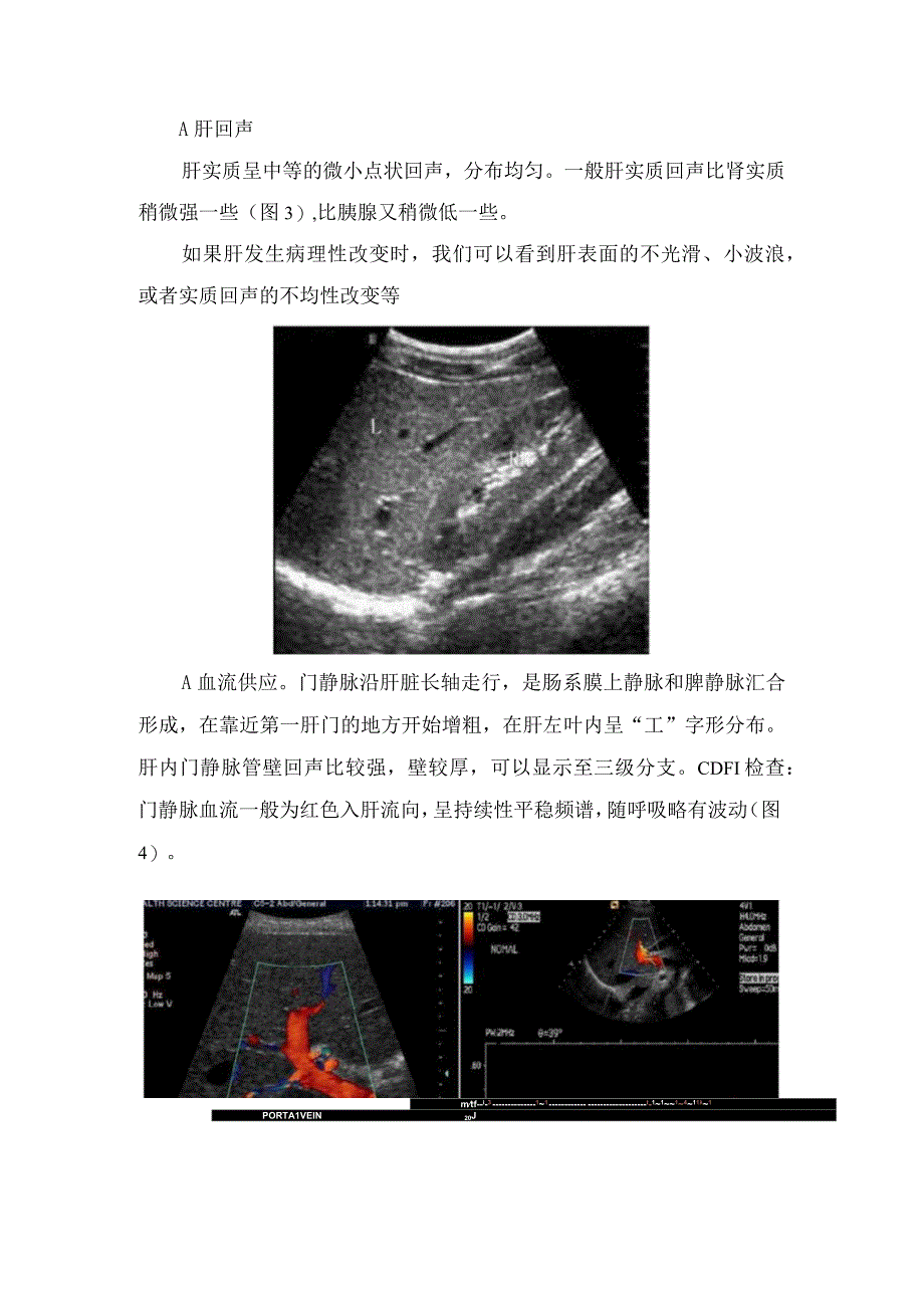 临床肝动态肝回声血液供应等正常肝脏声像图及肝右叶最大斜经厚度等测量切面和测量办法.docx_第2页