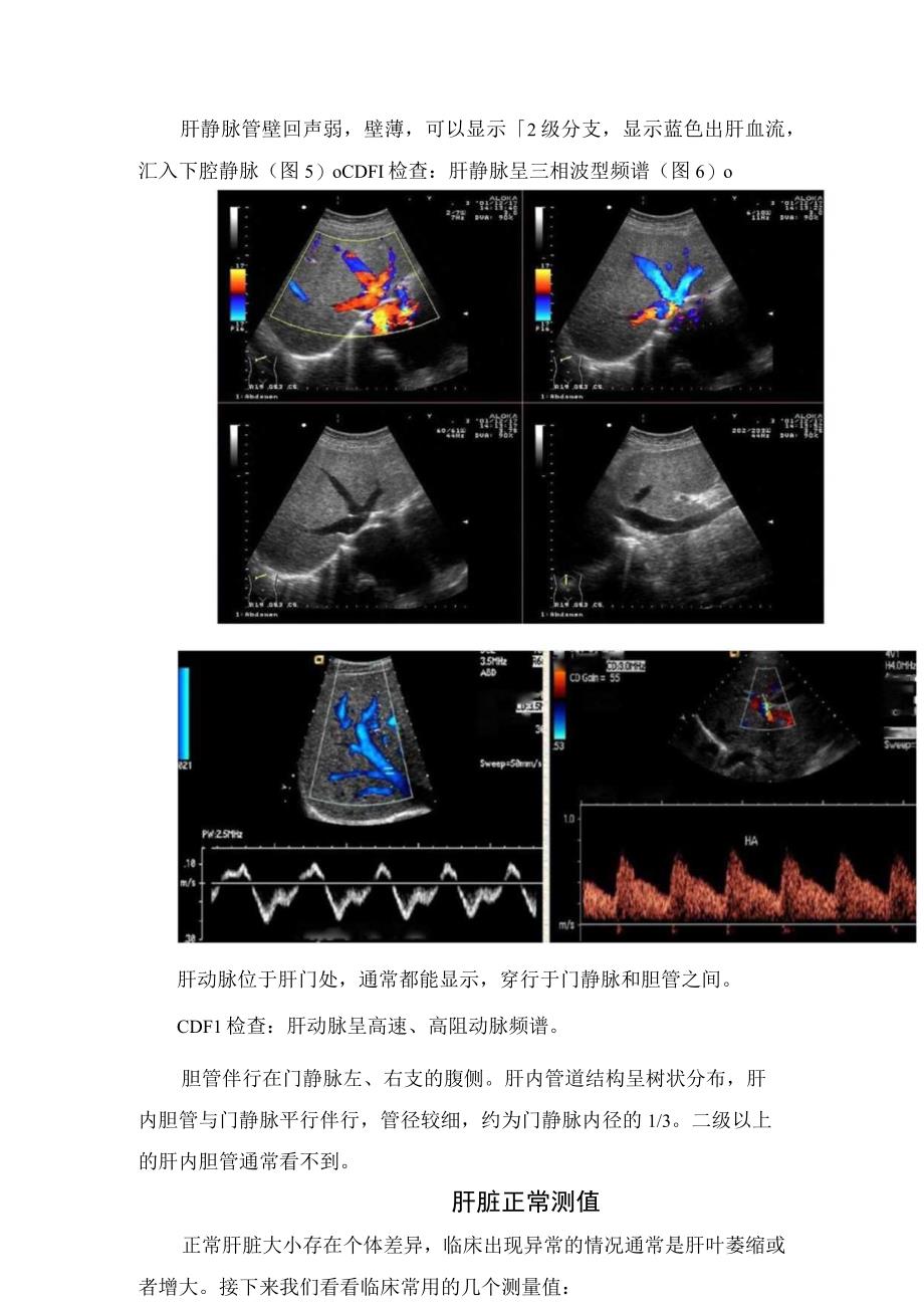 临床肝动态肝回声血液供应等正常肝脏声像图及肝右叶最大斜经厚度等测量切面和测量办法.docx_第3页