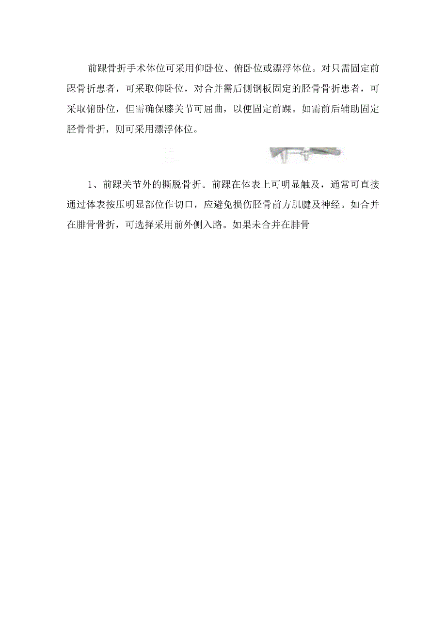 临床前踝骨折损伤机制骨折分类前踝手术治疗目的及手术指征.docx_第3页