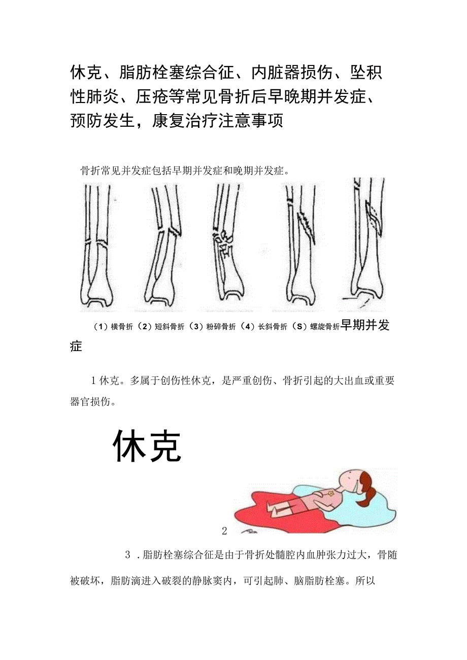 休克脂肪栓塞综合征内脏器损伤坠积性肺炎压疮等常见骨折后早晚期并发症预防发生康复治疗注意事项.docx_第1页