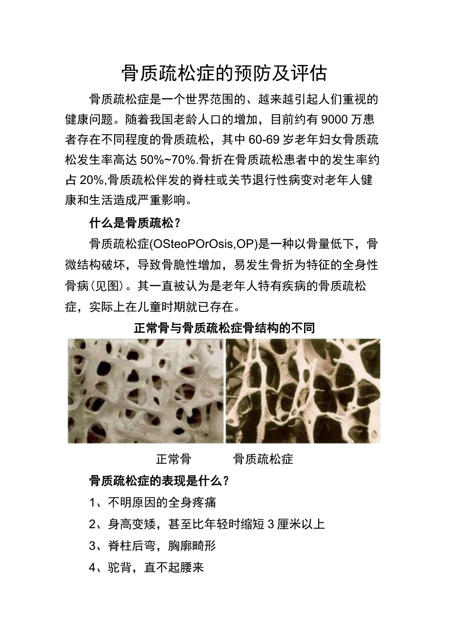 骨质疏松症的预防及评估.docx_第1页