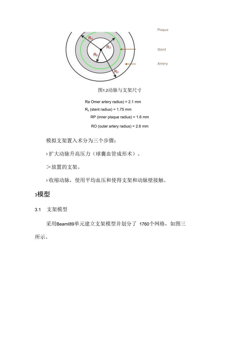 CAE心血管支架模拟.docx_第2页