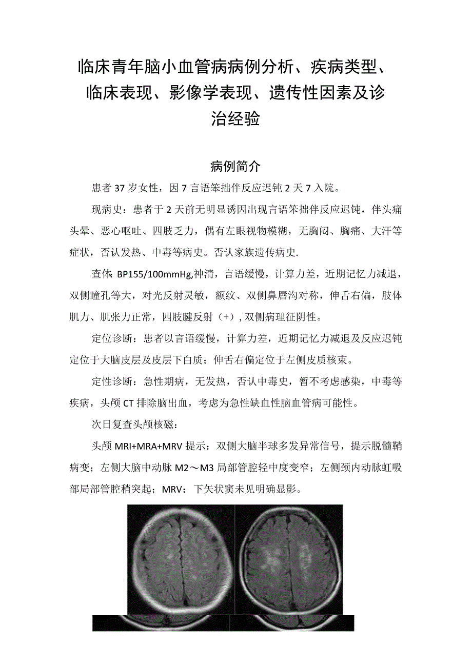 临床青年脑小血管病病例分析疾病类型临床表现影像学表现遗传性因素及诊治经验.docx_第1页