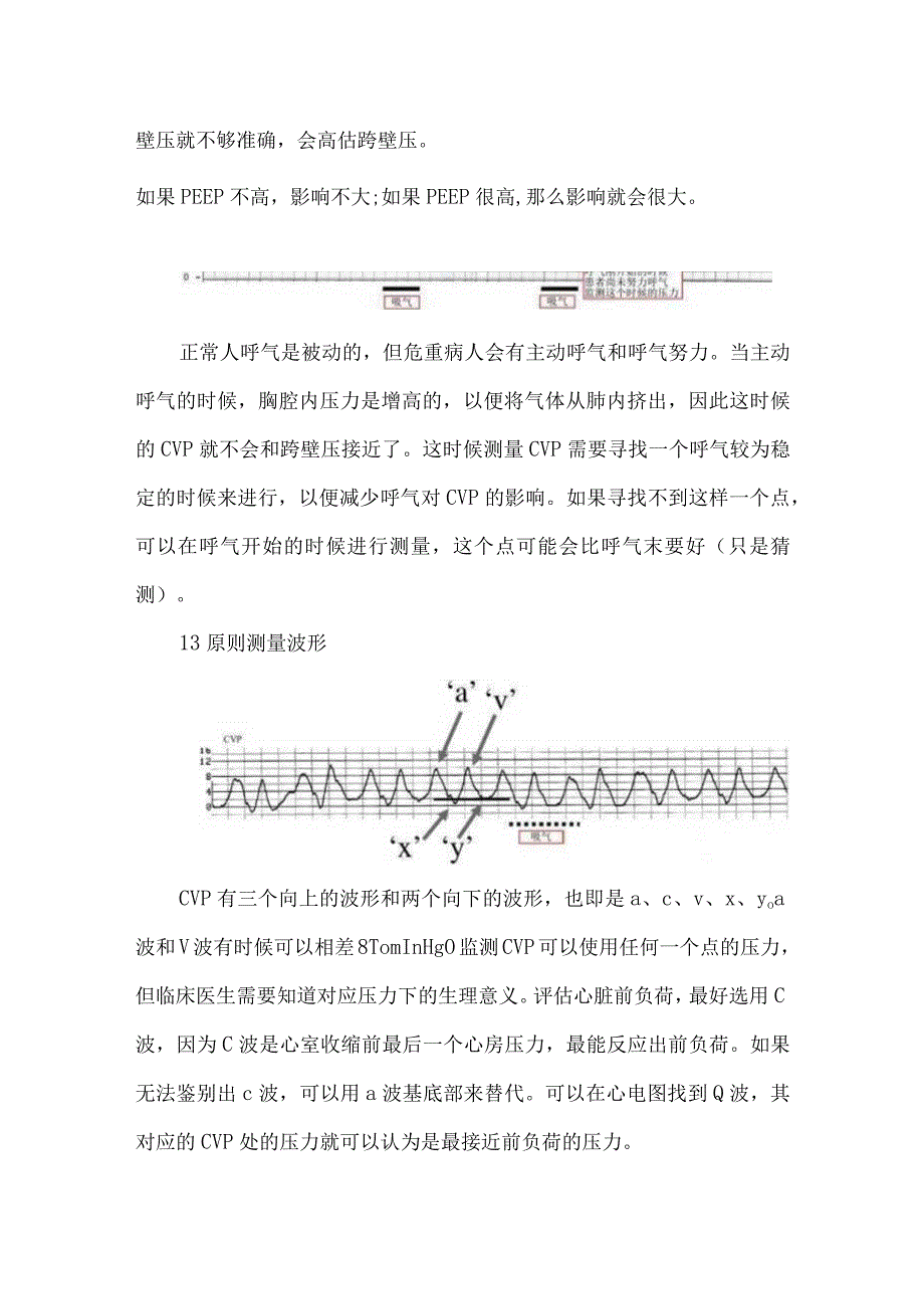 中心静脉压监测.docx_第2页