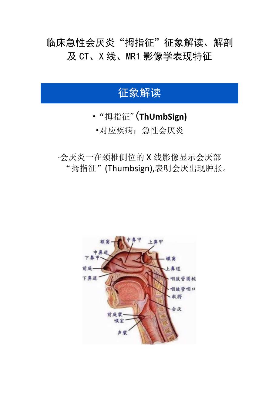 临床急性会厌炎拇指征征象解读解剖及CTX线MRI影像学表现特征.docx_第1页